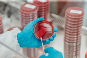 Diagnostics at Ripac-Labor